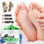 Foot Crack Cream For Dry Cracked Heels & Feet (50gm) Pack of 1