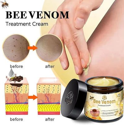 Zidella Skin Lighting Blemish Cream 50g (Pack of 2)